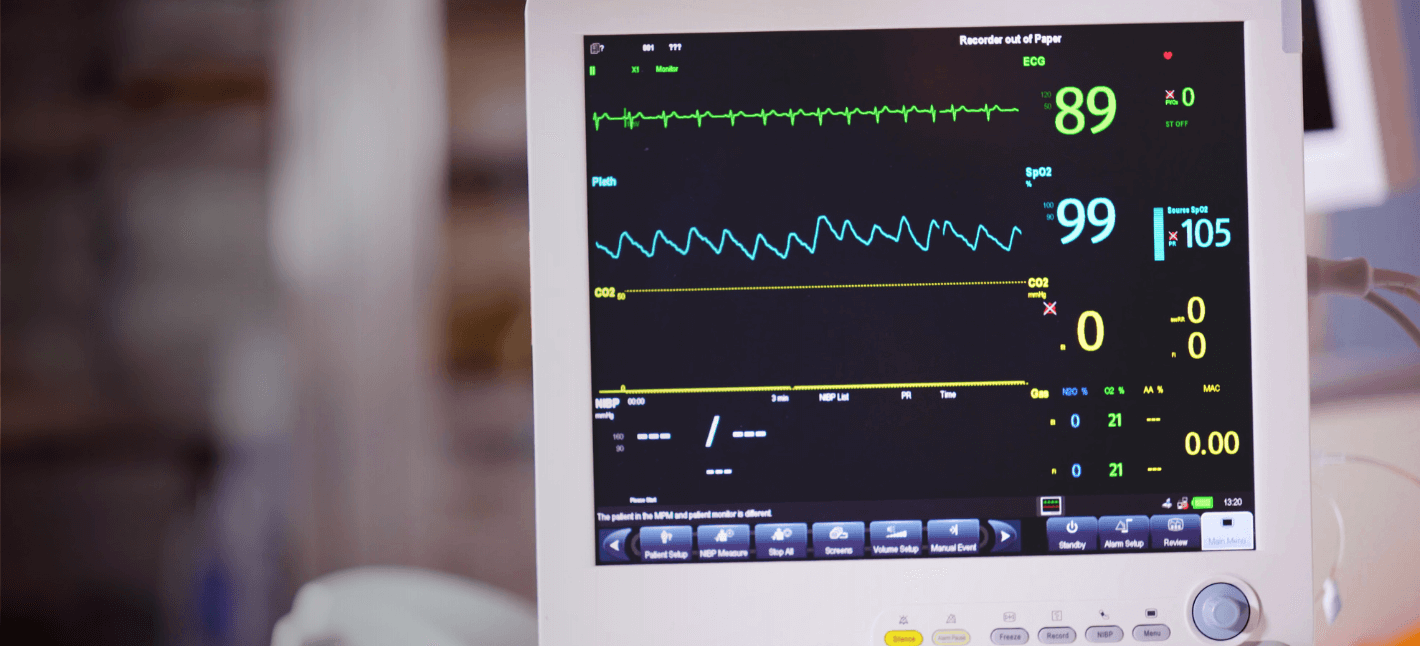 on the image you can see the ECG monitor showing a good pulse and vitals